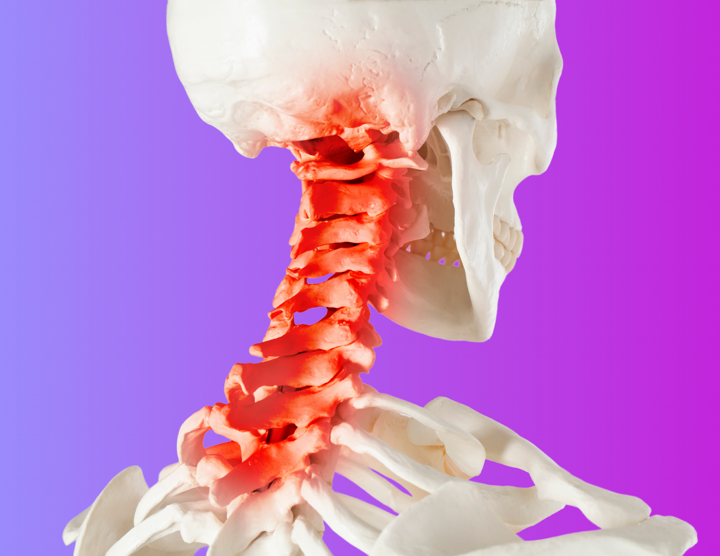 Osteopathy for neck pain
